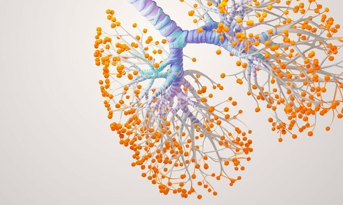 Asthma: From prevention to treatment