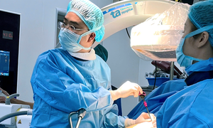 Should I have vertebroplasty for a compression fracture?
