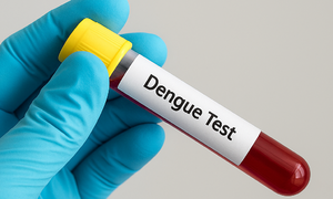 When to test for dengue fever?