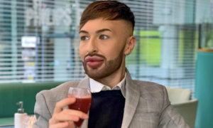 Man's face transformed by lip filler addiction