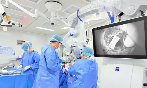 Minimally invasive brain surgery saves stroke patient