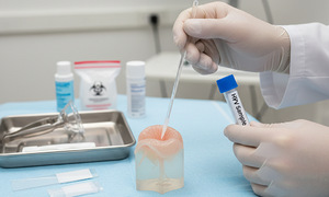 4 myths about HPV