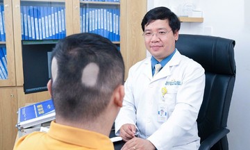 Early hair loss: a growing concern for young people