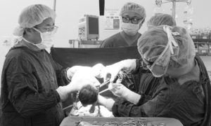 baby girl born safely, doctors remove mother's 4 kg fibroid
