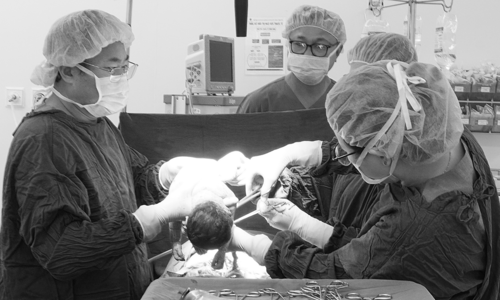 baby girl born safely, doctors remove mother's 4 kg fibroid