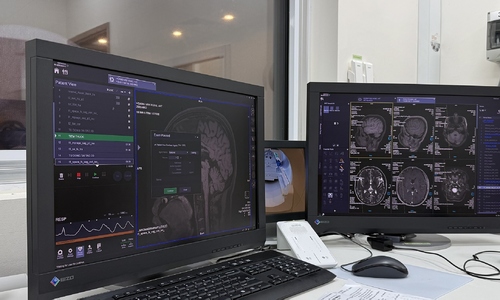 Multiple sclerosis: a disease causing blurred vision, numbness, and limb weakness
