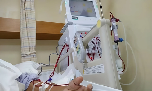 Three darkened body areas signal kidney failure