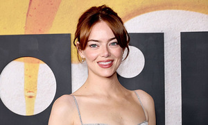 Why is Emma Stone considered to have the most beautiful face in the world?