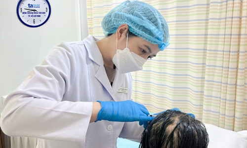 Costing hundreds of millions of dong, hair transplants still resulted in baldness