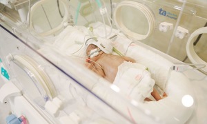 Saving a premature baby with stopped breathing and congenital heart disease