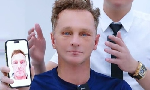 Western tourist gains fame after cosmetic surgery in Vietnam