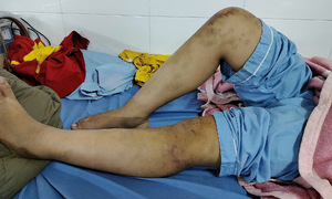 Three paternal family members arrested for torturing 13-year-old girl