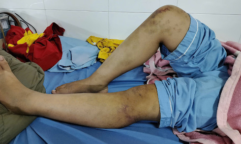 Three paternal family members arrested for torturing 13-year-old girl