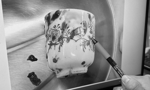 Man suffers bowel necrosis due to ceramic cup in rectum