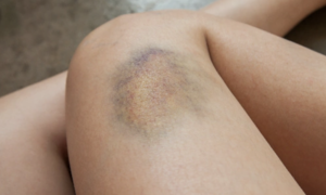 8 warning signs of cancer