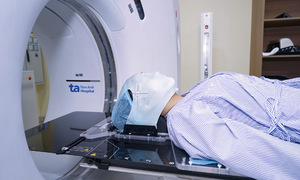 Why a mask is essential for head and neck cancer radiation therapy