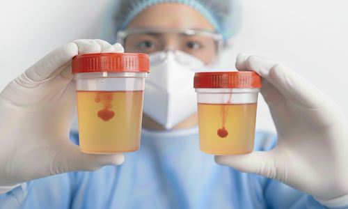 5 unusual signs that could signal cancer