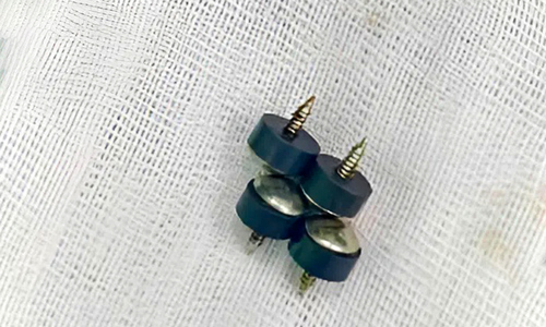 Two-year-old swallows four magnetic tacks