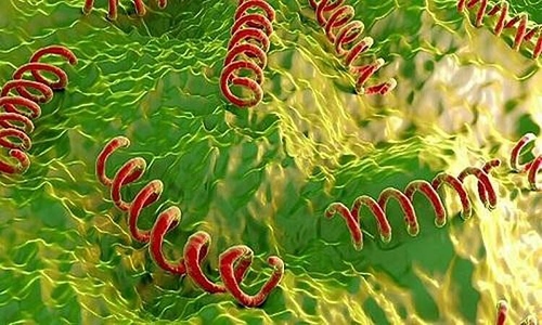 A 65-year-old man diagnosed with neurosyphilis