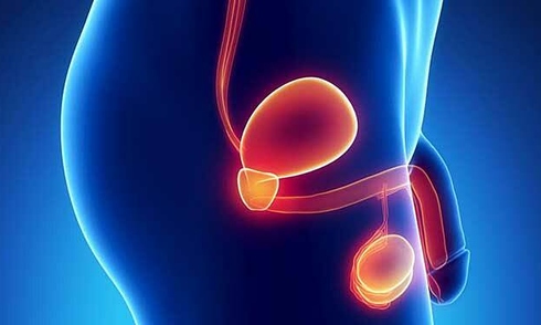 late-stage testicular cancer at age 19