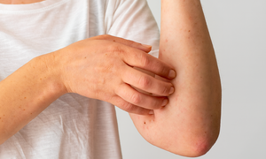 Silent signs warning of kidney weakness