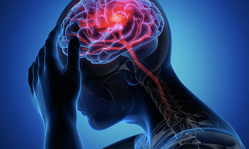 Stroke at 2 AM Bathroom Visit