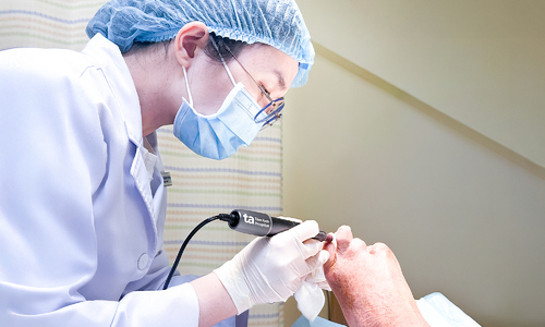 Small ulcer leads to toe necrosis due to diabetes complications