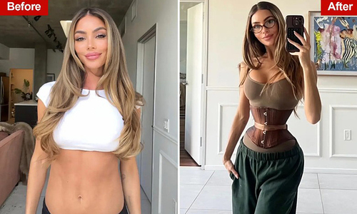 Enduring pain to cut ribs for an 'ant waist'