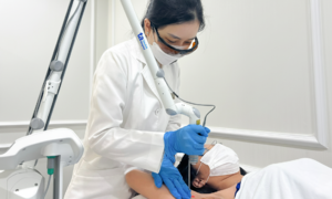 Underarm darkening after hair removal