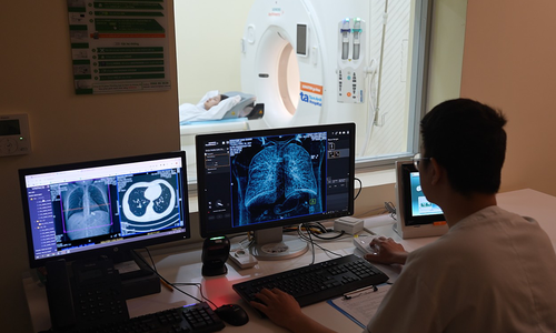 Does air pollution cause cancer?