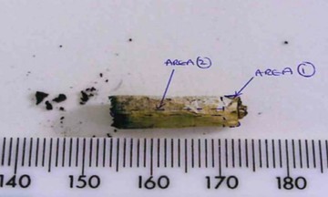 20-year cold case solved thanks to a cigarette butt