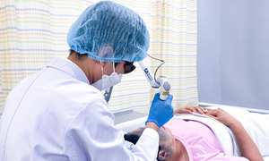 Laser treatment removes woman's birthmark covering half her face