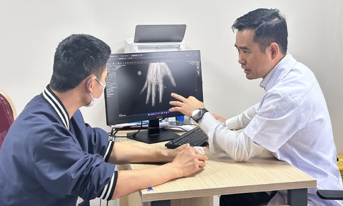 Severed finger successfully reattached after 25 hours