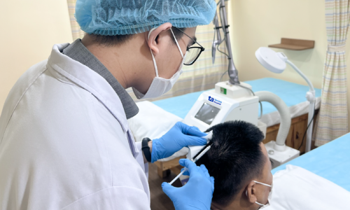 Seborrheic dermatitis causes itchy, burning scalp