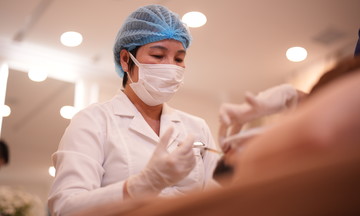 Can facial contouring fillers lead to skin sagging?