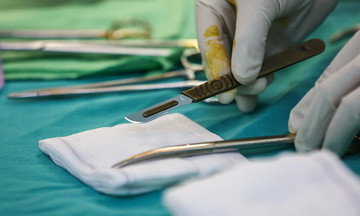 Boiling kettle spill severely burns 9-month-old baby