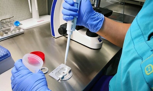 Nearly 200 children received cancer genes from a single sperm donor