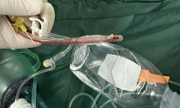 Three-year-old dies after choking on food at daycare