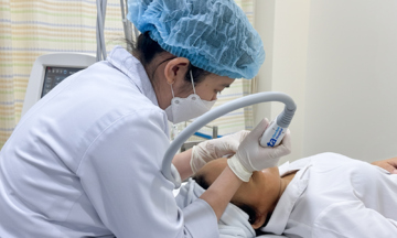 Micro-point radiofrequency technology for pore reduction