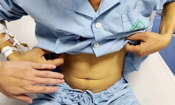 Near-fatal poisoning from carp bile consumed to 'boost virility'