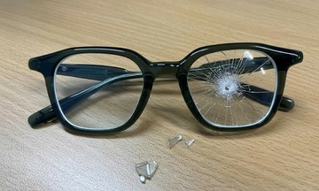 Girl suffers severe eye laceration from broken eyeglasses