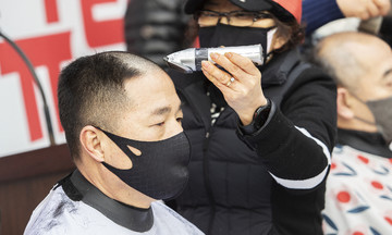 South Korean president seeks insurance coverage for hair loss treatment