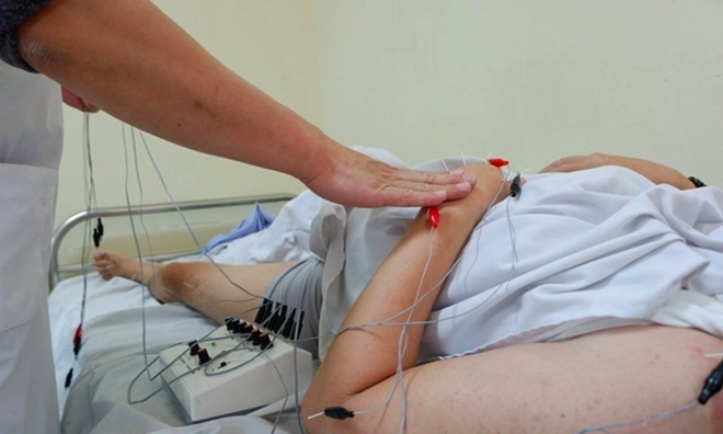 Combining eastern and western medicine to reduce stroke sequelae