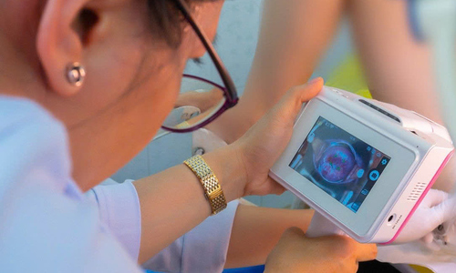 AI screens for cervical cancer in 5 minutes, at half the cost