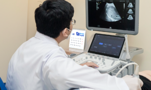 Fatty liver, hepatitis due to obesity at age 20