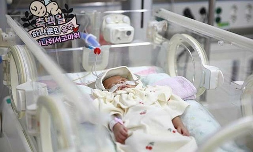 Premature baby weighing 300 grams discharged after 'less than 1% chance of survival' prognosis