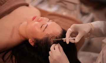 Who should not receive mesotherapy injections for hair loss?