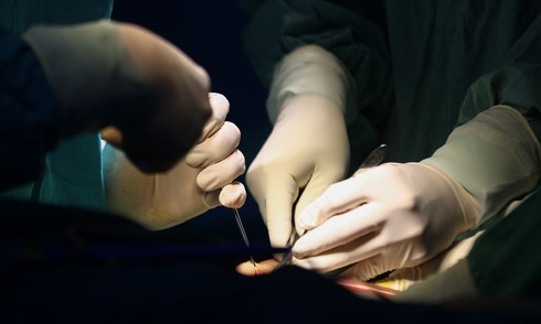 Saving the life of a 950-gram premature baby with necrotizing enterocolitis