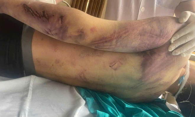 17-year-old male student dies one day after entering social work center