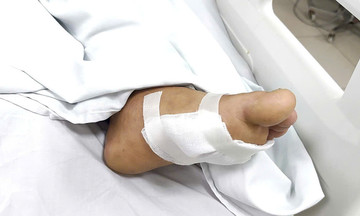 Minor scratch leaves man in critical condition